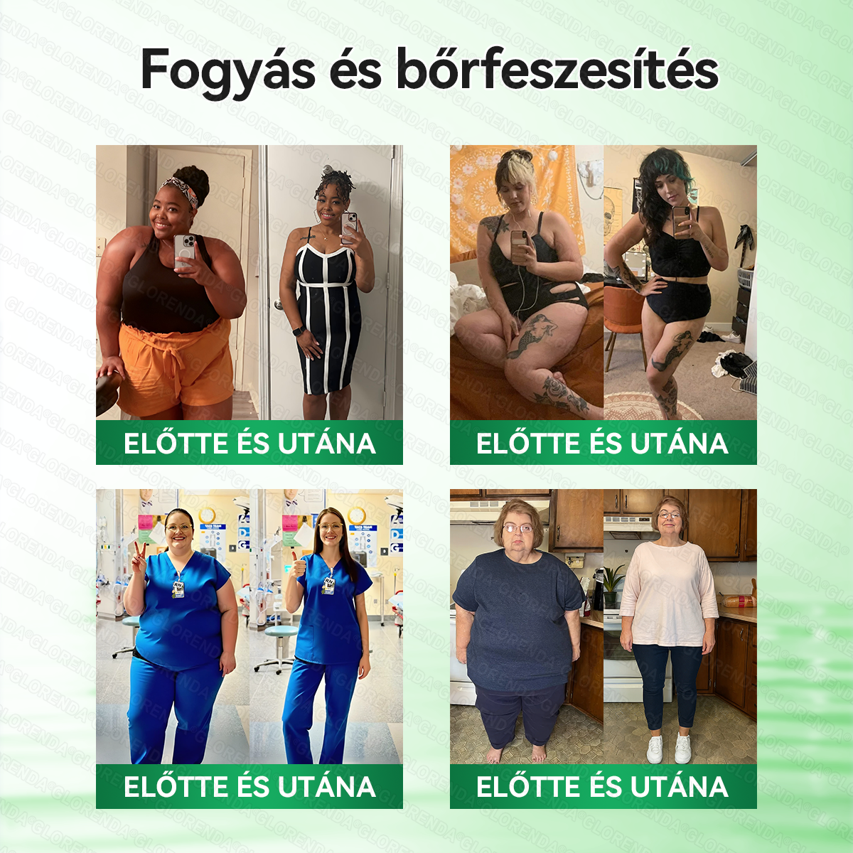 🔥𝑮𝑳𝑶𝑹𝑬𝐍𝐃𝗔®Glumasetide 8az 1-ben Karcsú és Egészséges Nano Mikrotűs Tapasz (Napi 1 alkalom – látható változás akár 7 nap alatt) ✅ Elhízásra, bőrfeszesítésre, cukorbetegségre, alvási apnoéra, ízületekre stb.