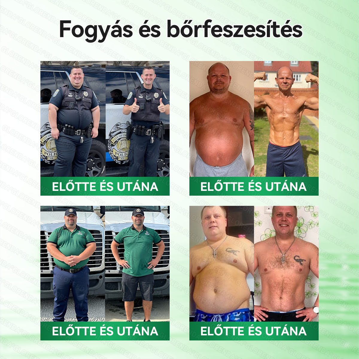🔥𝑮𝑳𝑶𝑹𝑬𝐍𝐃𝗔®Glumasetide 8az 1-ben Karcsú és Egészséges Nano Mikrotűs Tapasz (Napi 1 alkalom – látható változás akár 7 nap alatt) ✅ Elhízásra, bőrfeszesítésre, cukorbetegségre, alvási apnoéra, ízületekre stb.